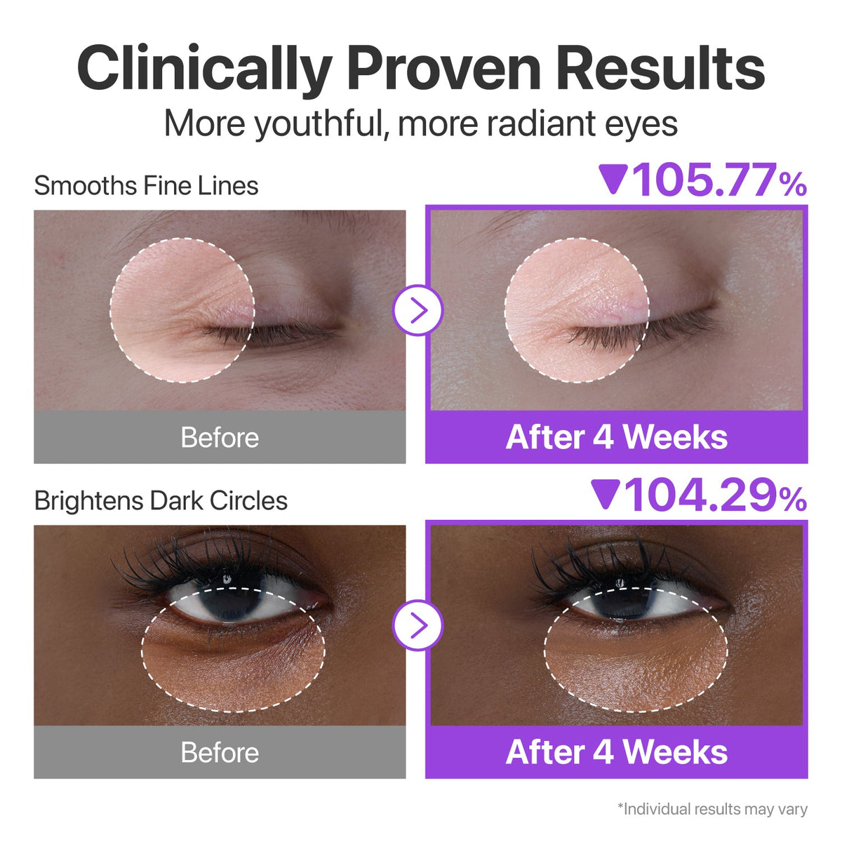 NAD+ Retinol Volumetox Eye Cream