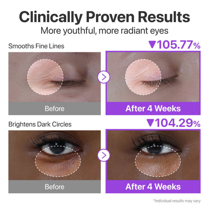 NAD+ Retinol Volumetox Eye Cream
