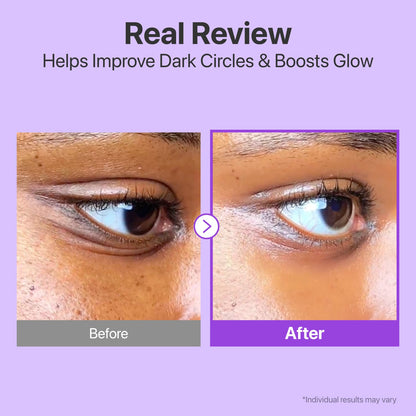 NAD+ Retinol Volumetox Eye Cream