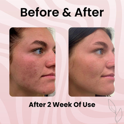 Glowpeel™ Collagen Peel Off Mask - Buy 1 Get 1 Free