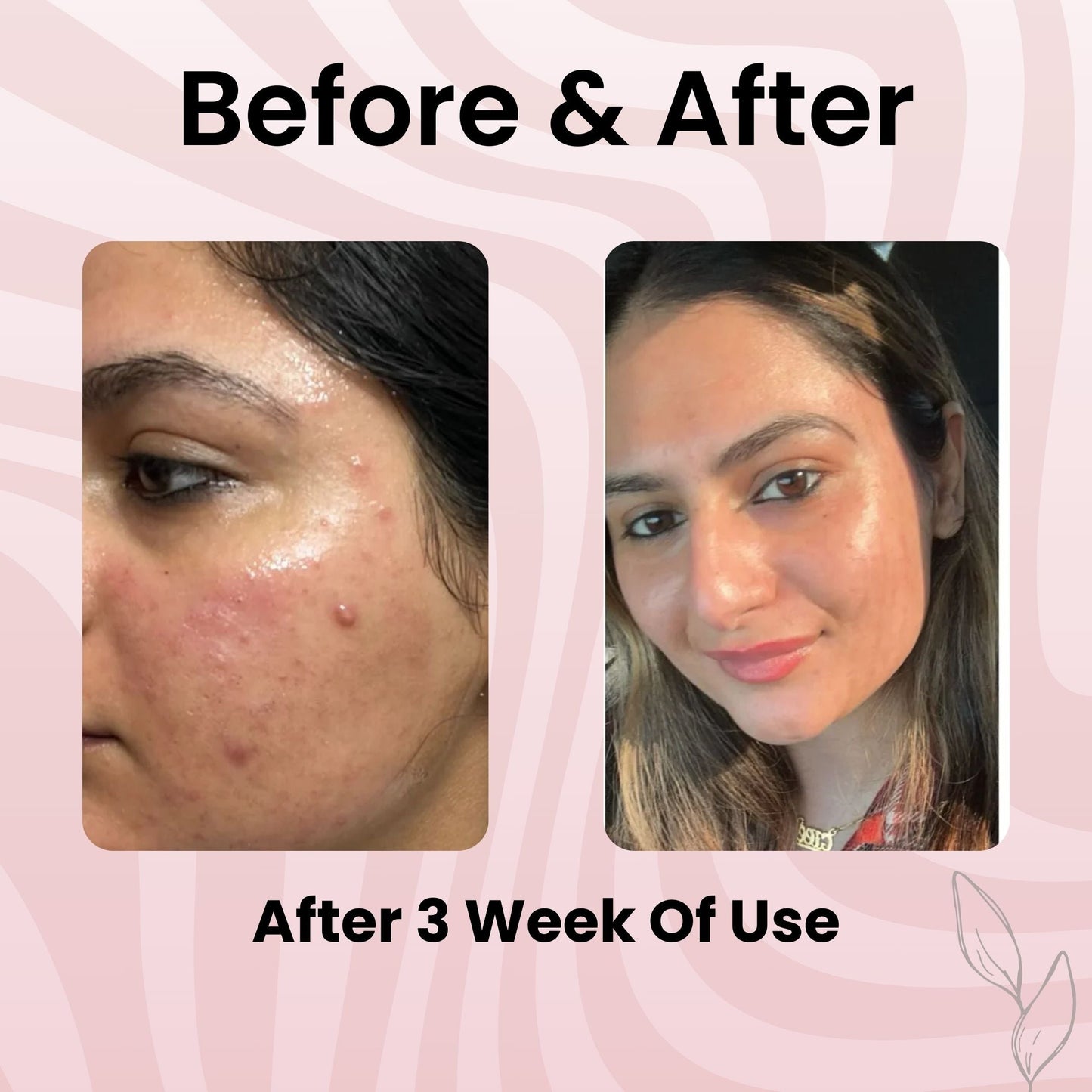 Glowpeel™ Collagen Peel Off Mask - Buy 1 Get 1 Free