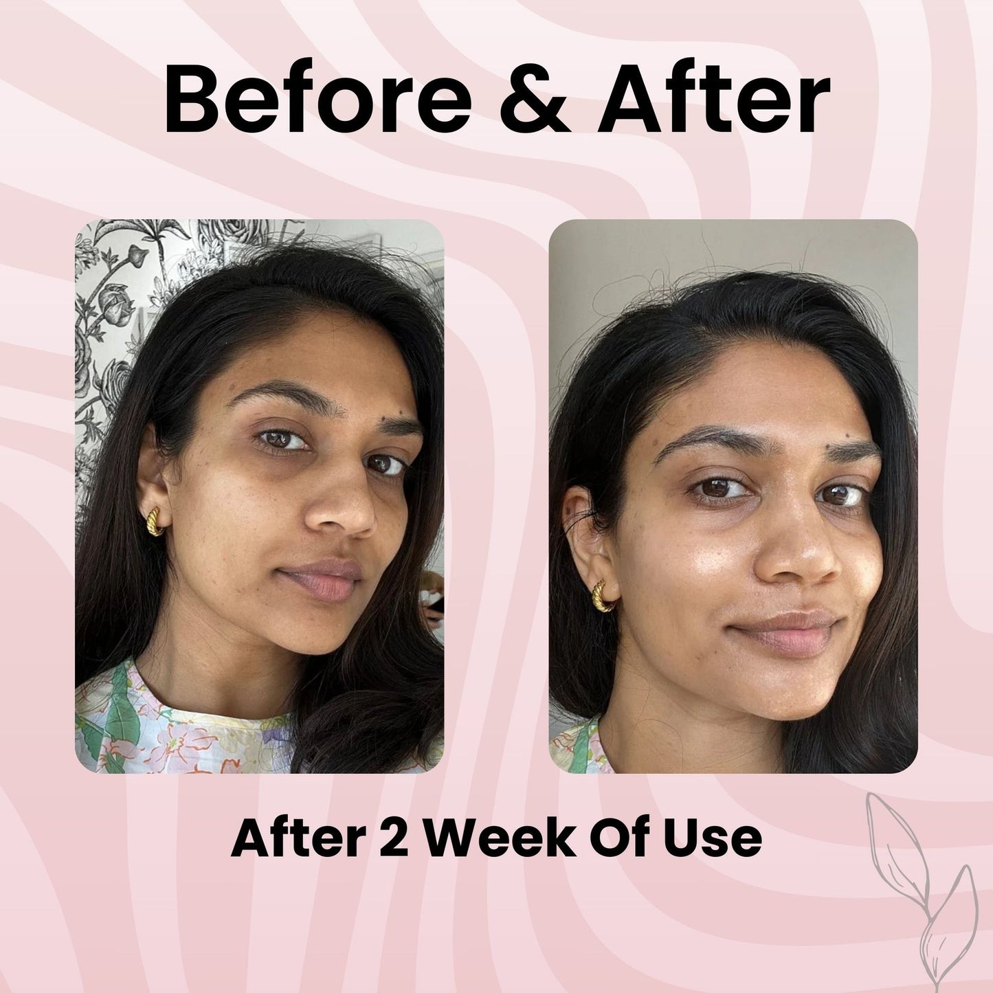 Glowpeel™ Collagen Peel Off Mask - Buy 1 Get 1 Free